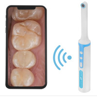 Wi-Fi-видеоскоп стоматолога МЕГЕОН 33038 к0000035623